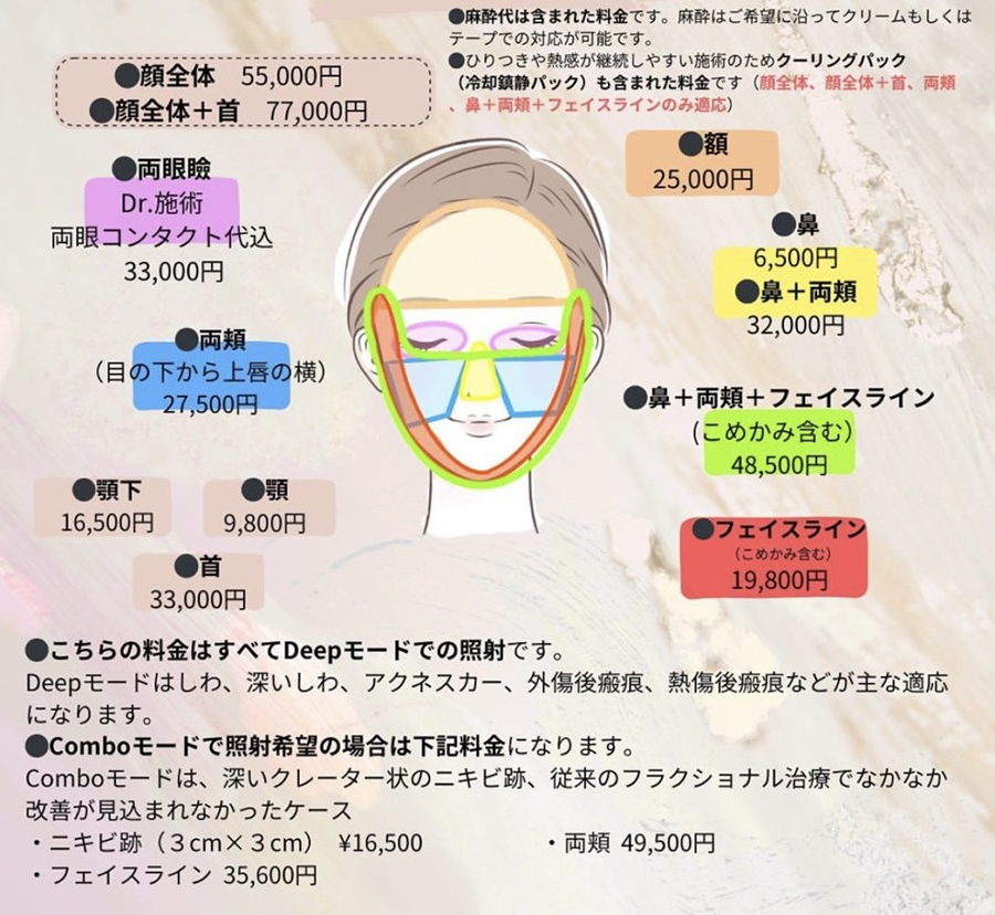 炭酸ガスレーザー(いぼ・ほくろ・フラクショナル)